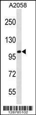 Anti-CEP112 Rabbit Polyclonal Antibody (PE (Phycoerythrin))