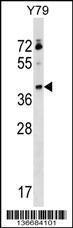 Anti-KLHDC8B Rabbit Polyclonal Antibody (AP (Alkaline Phosphatase))