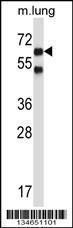 Anti-NLK Rabbit Polyclonal Antibody (APC (Allophycocyanin))