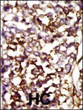 Anti-CDK4 Rabbit Polyclonal Antibody (AP (Alkaline Phosphatase))