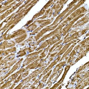 Immunohistochemistry analysis of paraffin-embedded mouse heart using Anti-BNP Antibody (A11515) at a dilution of 1:200 (40X lens). Perform high pressure antigen retrieval with 10 mM citrate buffer pH 6.0 before commencing with IHC staining protocol