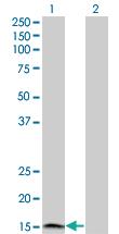 Anti-IFNA2 Mouse Monoclonal Antibody [clone: 2B1]