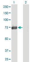 Anti-ACSS1 Mouse Polyclonal Antibody