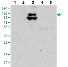 Anti-FAM186B Rabbit Polyclonal Antibody