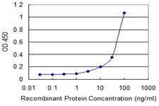 Anti-ERBB2 Mouse Monoclonal Antibody [clone: 4E1]