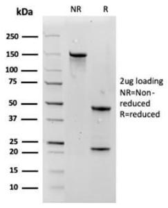 SDS-PAGE analysis of Anti-Aquaporin 4 Antibody [AQP4/3324] under non-reduced and reduced conditions; showing intact IgG and intact heavy and light chains, respectively. SDS-PAGE analysis confirms the integrity and purity of the Antibody