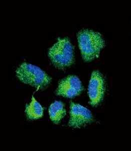 Anti-CHAT Rabbit Polyclonal Antibody