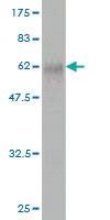 Anti-FBXO22 Mouse Monoclonal Antibody [clone: 6G9]