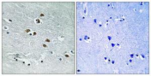 Immunohistochemical analysis of paraffin-embedded human brain tissue using Anti-HDAC6 Antibody. The right hand panel represents a negative control, where the antibody was pre-incubated with the immunising peptide