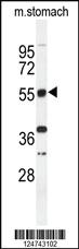 Anti-MAP1LC3B Rabbit Polyclonal Antibody