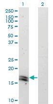 Anti-IFNA2 Mouse Monoclonal Antibody [clone: 1A9]