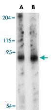 Anti-SLITRK6 Rabbit Polyclonal Antibody