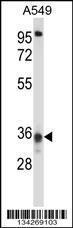 Anti-CCDC50 Rabbit Polyclonal Antibody (APC (Allophycocyanin))