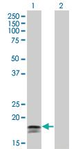 Anti-IFNA2 Mouse Monoclonal Antibody [clone: 4H3]