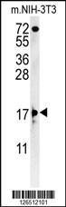 Anti-ENY2 Rabbit Polyclonal Antibody