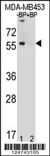 Anti-MAP1LC3B Rabbit Polyclonal Antibody