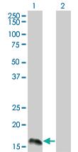 Anti-IFNA2 Mouse Monoclonal Antibody [clone: 1A11]