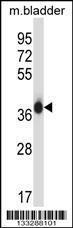 Anti-EIF2S1 Rabbit Polyclonal Antibody (HRP (Horseradish Peroxidase))