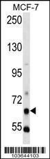 Anti-PCK1 Rabbit Polyclonal Antibody (AP (Alkaline Phosphatase))