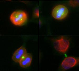 HeLa cell cultures were stained with Anti-Aurora A/B Kinase Antibody (green)