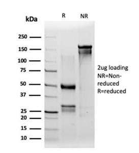 SDS-PAGE analysis of Anti-IRF3 Antibody [PCRP-IRF3-1D11] under non-reduced and reduced conditions; showing intact IgG and intact heavy and light chains, respectively. SDS-PAGE analysis confirms the integrity and purity of the antibody