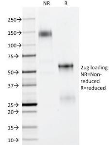 SDS-PAGE analysis of Anti-p63 Antibody [TP63/11] under non-reduced and reduced conditions; showing intact IgG and intact heavy and light chains, respectively. SDS-PAGE analysis confirms the integrity and purity of the antibody.