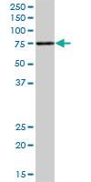 Anti-ACSS1 Mouse Polyclonal Antibody