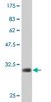 Anti-HHLA3 Mouse Monoclonal Antibody [clone: 1F6]