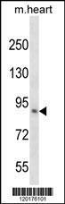 Anti-KLHL1 Rabbit Polyclonal Antibody (APC (Allophycocyanin))