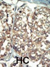 Anti-PI 4 Kinase Type 2 beta Rabbit Polyclonal Antibody (FITC (Fluorescein))