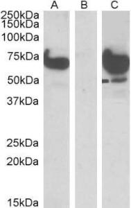 Anti-EPM2AIP1 Goat Polyclonal Antibody