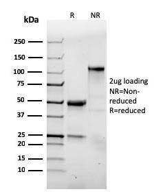 SDS-PAGE analysis of Anti-Integrin alpha E Antibody [ITGAE/3904R] under non-reduced and reduced conditions; showing intact IgG and intact heavy and light chains, respectively SDS-PAGE analysis confirms the integrity and purity of the antibody