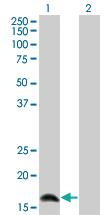 Anti-IFNA2 Mouse Monoclonal Antibody [clone: 2C10]