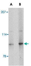 Anti-SLITRK4 Rabbit Polyclonal Antibody