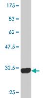 Anti-PLP1 Mouse Monoclonal Antibody [clone: 2D7]