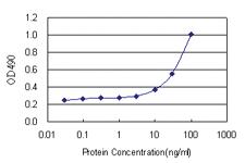 Anti-C4BPB Antibody Pair