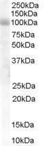 Anti-HPS6 Antibody (A84060) staining (1 µg/ml) of Human Lung lysate (RIPA buffer, 30 µg total protein per lane). Primary incubated for 1 hour. Detected by western blot using chemiluminescence