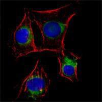 Anti-NGFR Mouse Monoclonal Antibody [clone: 2F1C2]