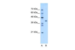 Anti-TMEM59L Rabbit Polyclonal Antibody