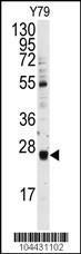 Anti-UBE2E3 Rabbit Polyclonal Antibody (FITC (Fluorescein))