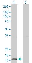 Anti-IFNA2 Mouse Monoclonal Antibody [clone: 2D6]