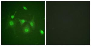 Immunofluorescence analysis of HepG2 cells using Anti-HDAC6 Antibody. The right hand panel represents a negative control, where the antibody was pre-incubated with the immunising peptide