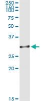 Anti-OLIG1 Mouse Monoclonal Antibody [clone: 3B3]