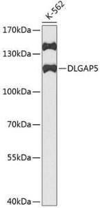 Anti-HURP Antibody (A11516)