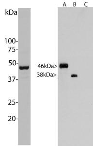 Left: Western blot analysis of Anti-Aurora A/B Kinase Antibody in HeLa cells