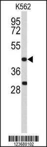 Anti-DFFA Rabbit Polyclonal Antibody (AP (Alkaline Phosphatase))