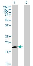 Anti-IL20RB Mouse Polyclonal Antibody