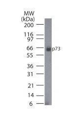 Anti-BRCA1 Mouse Monoclonal Antibody (HRP (Horseradish Peroxidase)) [clone: KEN]