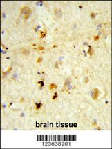 Anti-Integrin beta-like 1 with EGF-like Repeat Domains Rabbit Polyclonal Antibody (HRP (Horseradish Peroxidase))