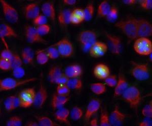 HeLa cell cultures were stained with Anti-Aurora A/B Kinase Antibody (green)